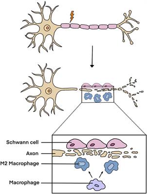 Single-cell profiling of cellular changes in the somatic peripheral nerves following nerve injury